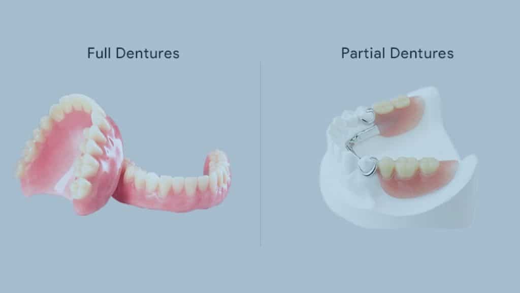 toronto full partial dentures