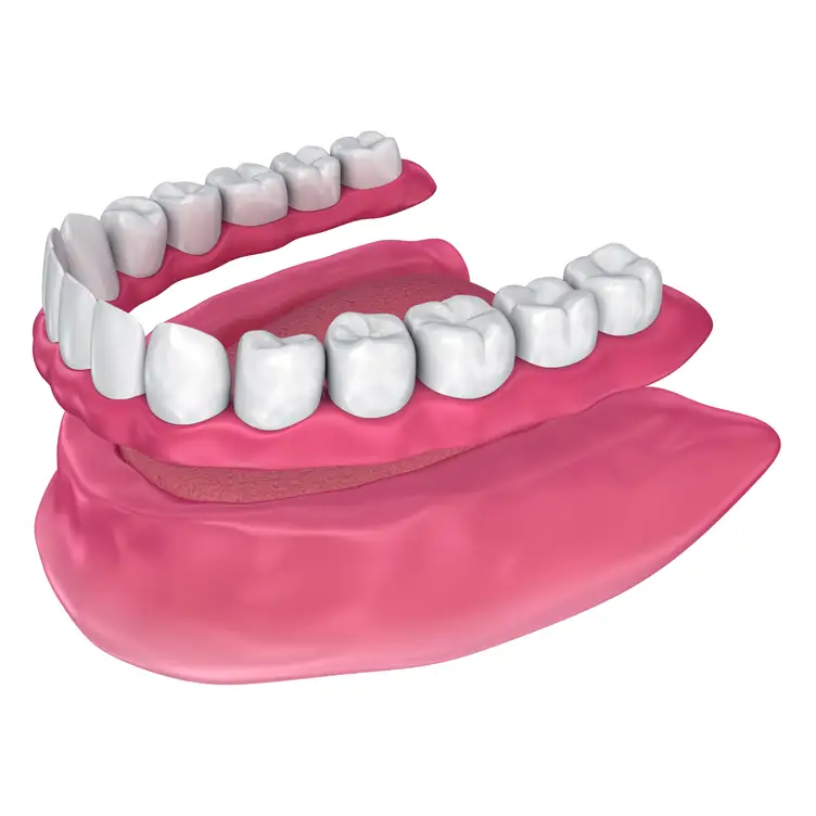 Illustration depicting a traditional denture