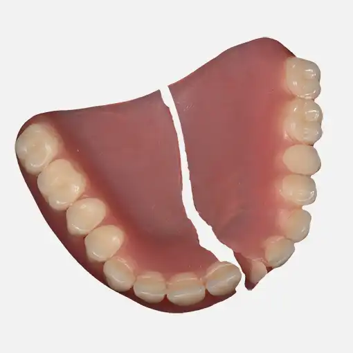 Photo of a broken denture needing repair.