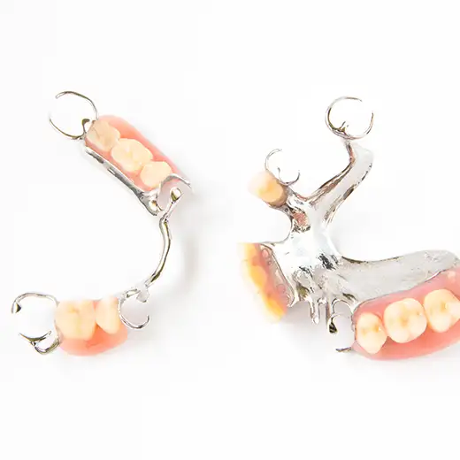 Photo of cast metal partial denture