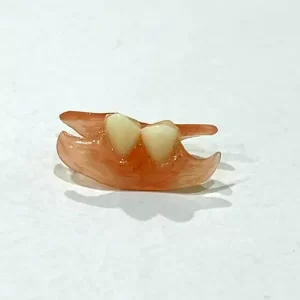 Photo of a dental flipper made by Toronto denturist Meri Paparisto