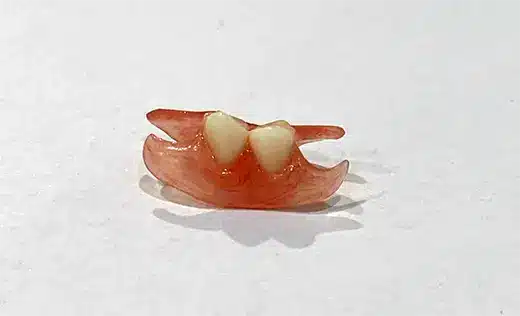 Photo of a Dental Flipper Made By Toronto Denturist Meri Paparisto