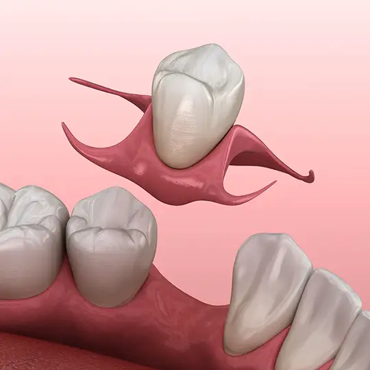 High resolution illustration of a dental flipper.