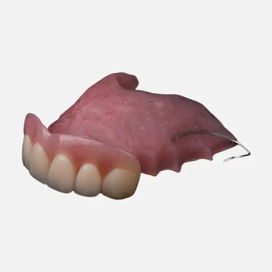 Photo of Acrylic Resin Partial Denture