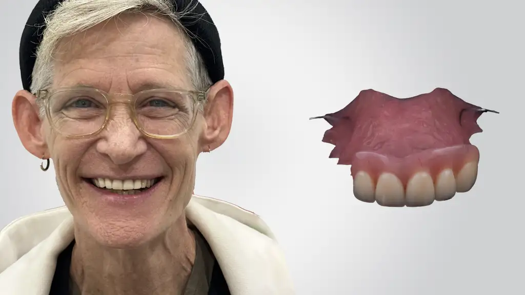 partial dentures toronto