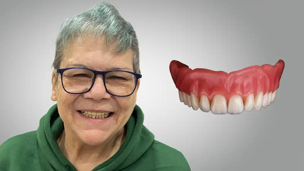 complete dentures