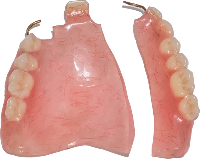 Example of a Denture Repair.